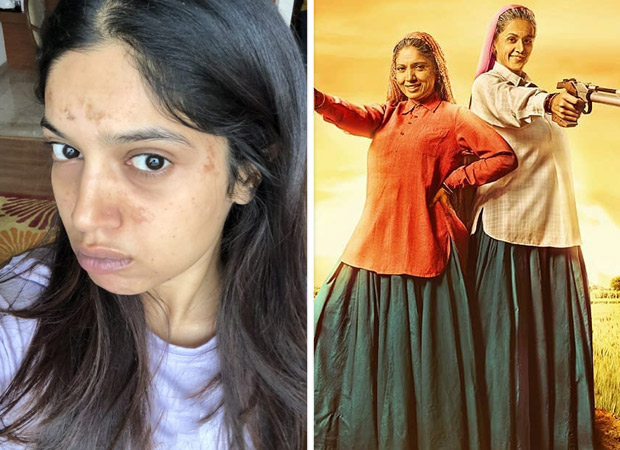 Bhumi Pednekar Gets Blisters On Her Face During The Shoot Of Saand Ki Aankh Bollywood News Bollywood Hungama Find the perfect bhumi pednekar stock photos and editorial news pictures from getty images. bhumi pednekar gets blisters on her