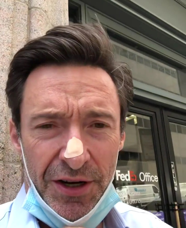 Hugh Jackman Undergoes Skin Biopsy For Possible Cancer Scare