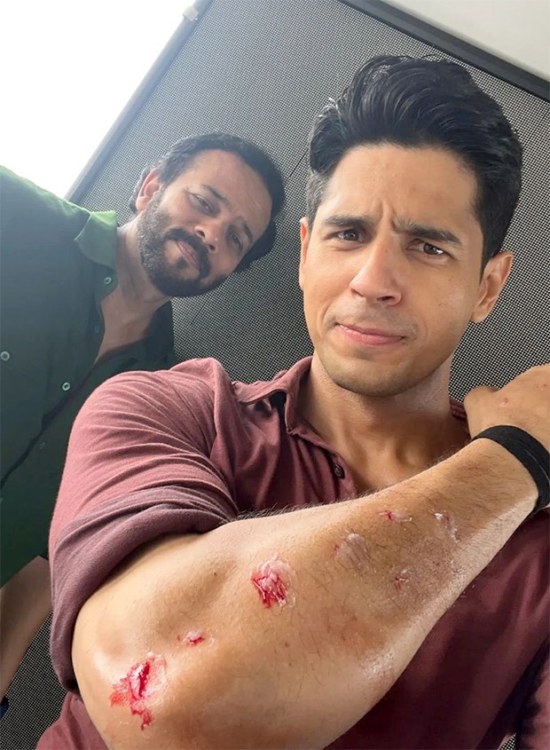 Sidharth Malhotra gets injured shooting Indian Police Force in Goa - "Rohit Shetty’s action hero equals to real sweat, real blood" Sidharth Malhotra gets injured shooting Indian Police Force in Goa - "Rohit Shetty’s action hero equals to real sweat, real blood"