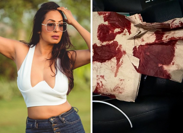 Kashmera Shah narrowly escapes &ldquo;freak” accident in the USA, shares photos of blood-soaked tissue: &ldquo;Kuch bada hone wala tha…”